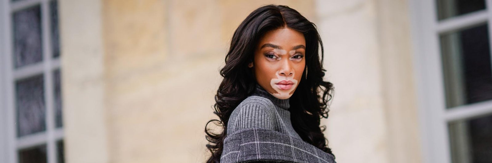 البهاق: أنواعه وطرق علاجه الحديثة من بينها الليزر